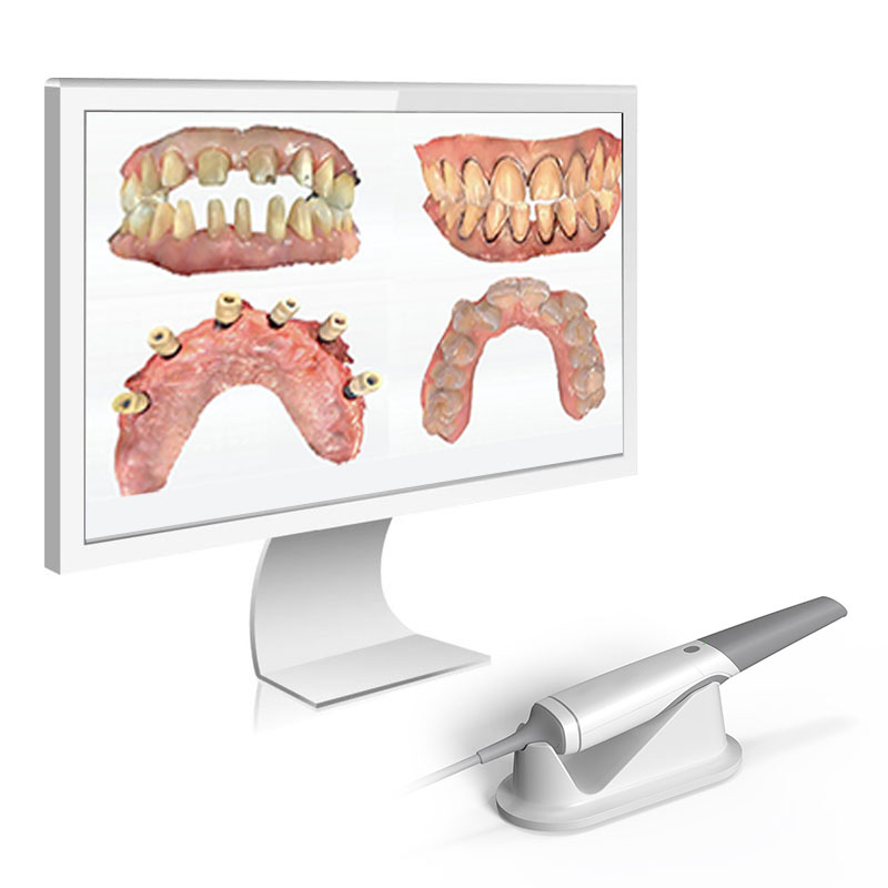 intraoral scanners