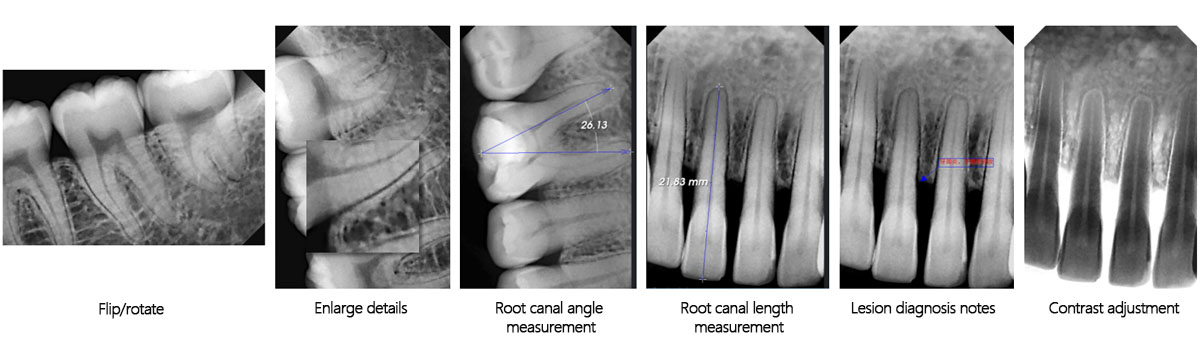 dental x ray machine