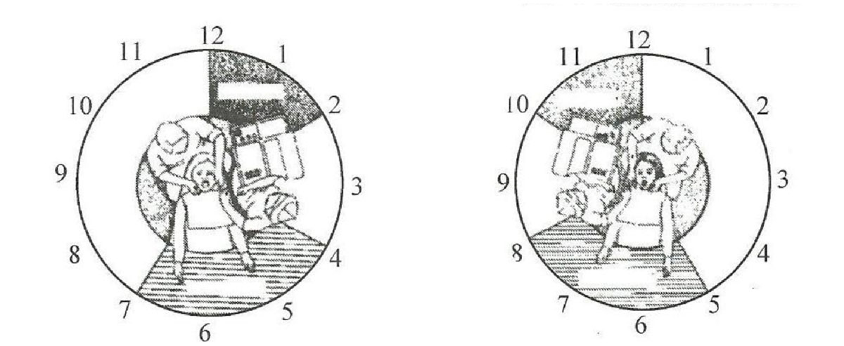 Four-hand Operation
